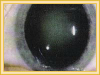 Cirujanos oftalmologia para operacion de ojos con laser.